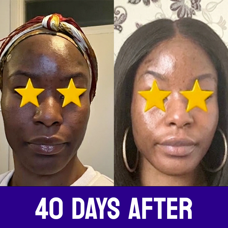 Even Tone Face Cream